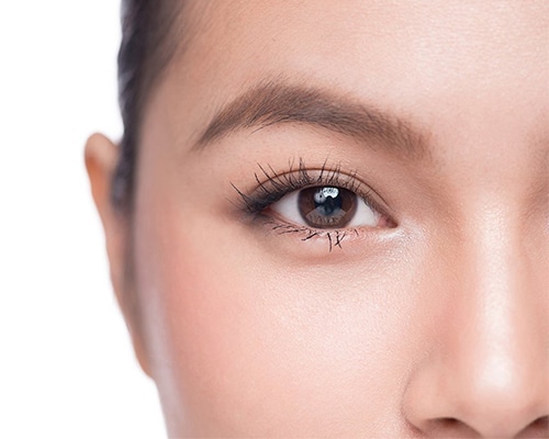 Double Eyelid Cosmetic Procedure Before and After - Bioscor International