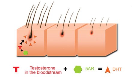 hair loss treatments | Bioscor International